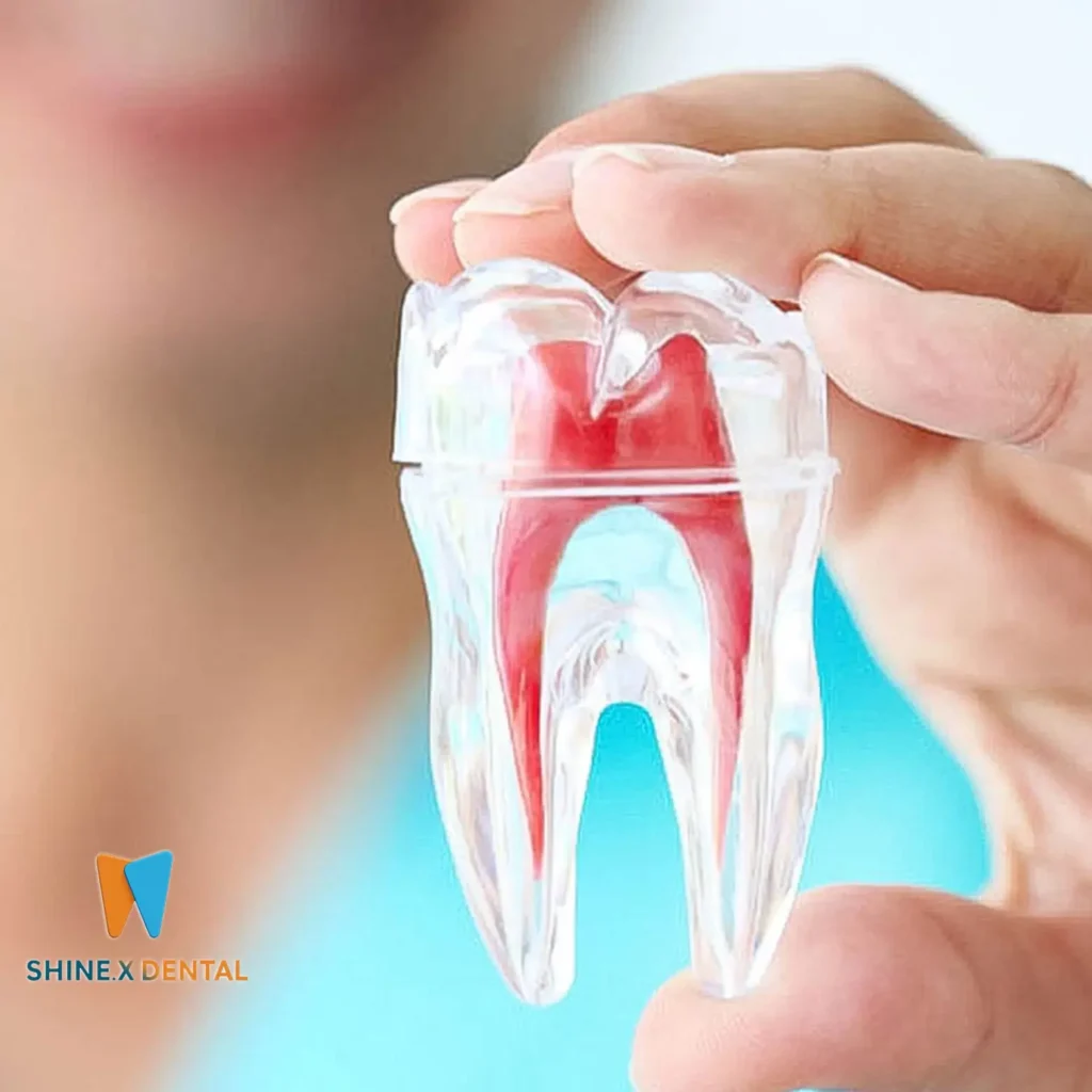 عکس کاور مراحل اصلی در درمان ریشه (اندودانتیکس)